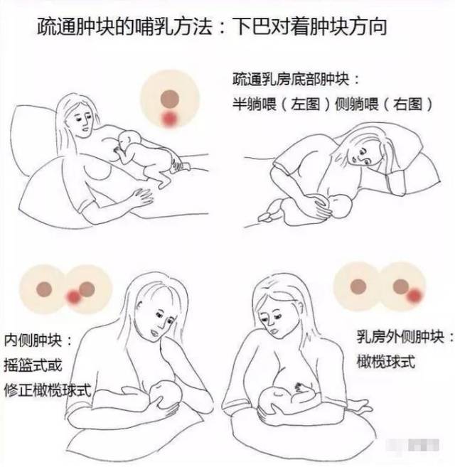 產(chǎn)后漲奶，疼痛難忍怎么辦？