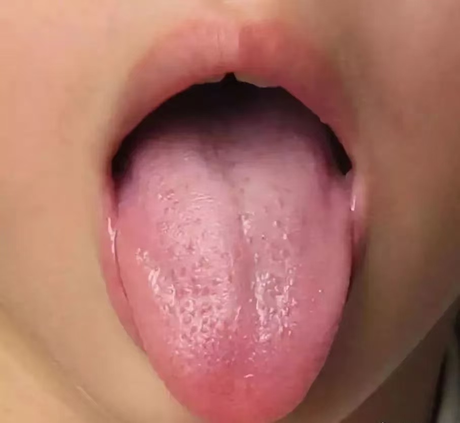 過度喂養(yǎng)危害大，寶寶發(fā)出的積食信號你能看懂多少？