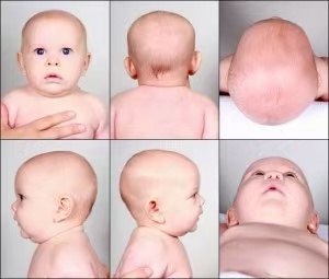 育兒小妙招|4個小妙招，幫寶寶睡出好頭型，趕緊收藏