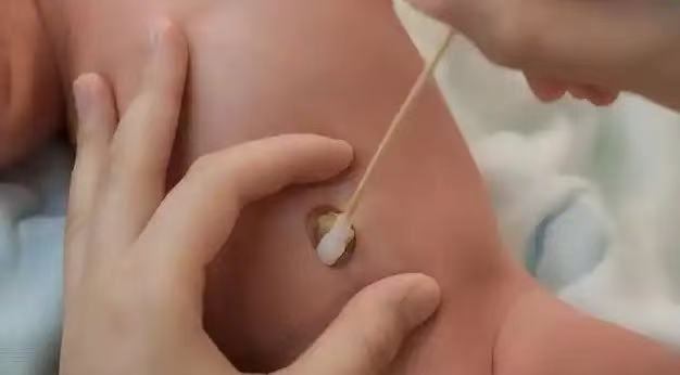  肚臍眼里的污垢，到底能不能摳？ 