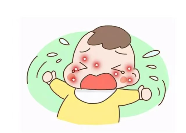 孩子濕疹反復發(fā)作怎么辦？這些防治方法請收好！